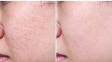 151134102.jpg 22-6.jpg