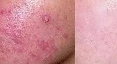 151140129.jpg 22-7.jpg